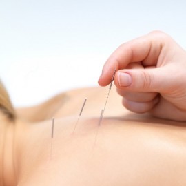 Dry-Needling1-270×270